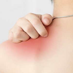Remedio Natural para Picores / Irritaciones